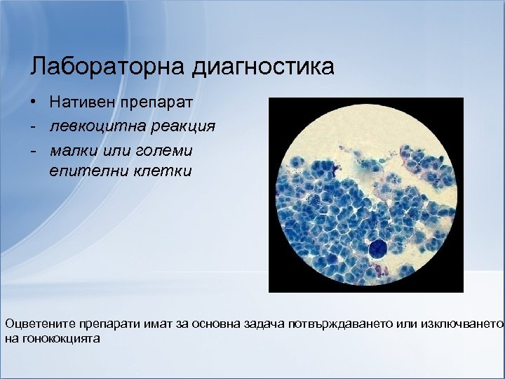 Лабораторна диагностика • Нативен препарат - левкоцитна реакция - малки или големи епителни клетки