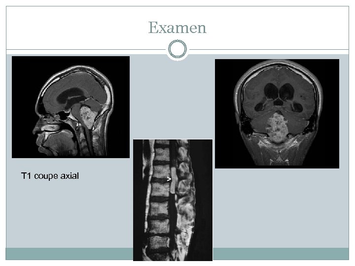 Examen T 1 coupe axial 