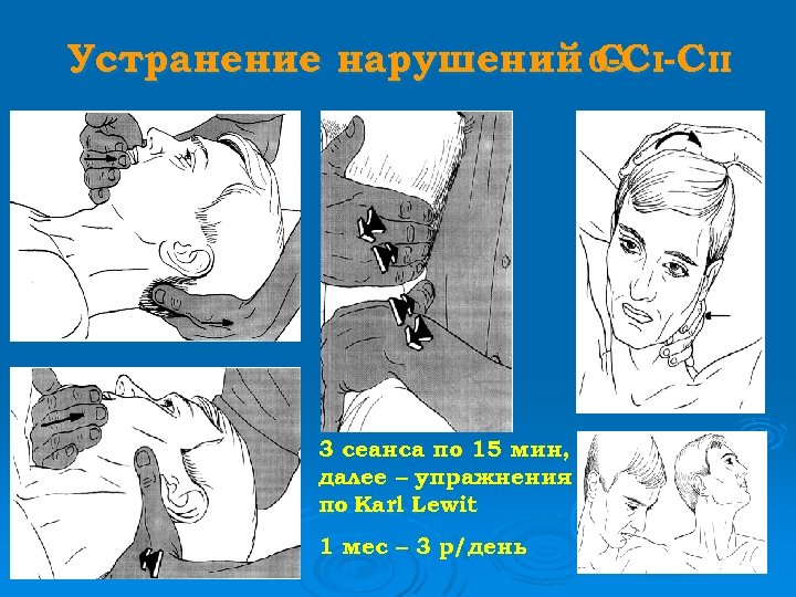 Устранение нарушений 0 -C II С 3 сеанса по 15 мин, далее – упражнения