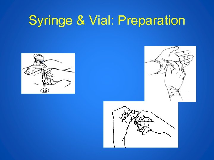 Syringe & Vial: Preparation 