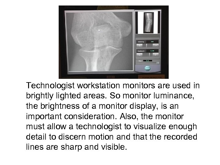 Technologist workstation monitors are used in brightly lighted areas. So monitor luminance, the brightness