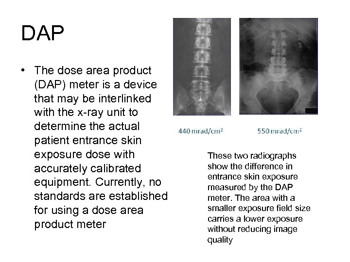 DAP • The dose area product (DAP) meter is a device that may be