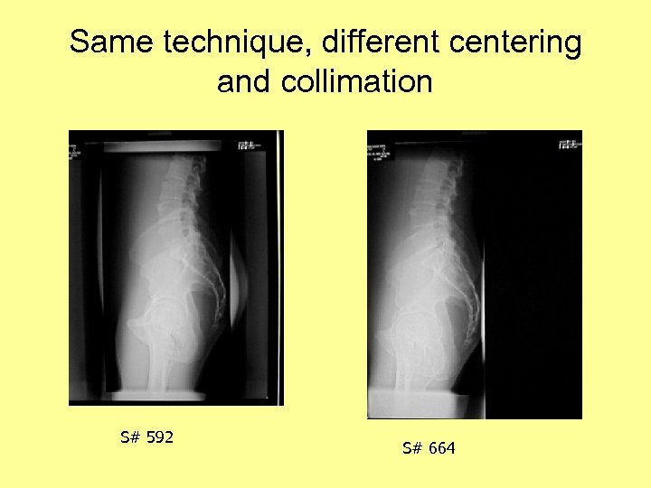 Same technique, different centering and collimation S# 592 S# 664 