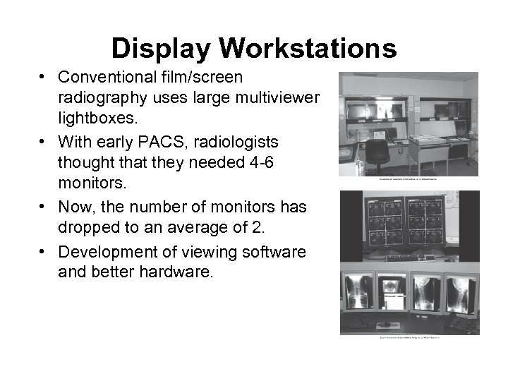 Display Workstations • Conventional film/screen radiography uses large multiviewer lightboxes. • With early PACS,