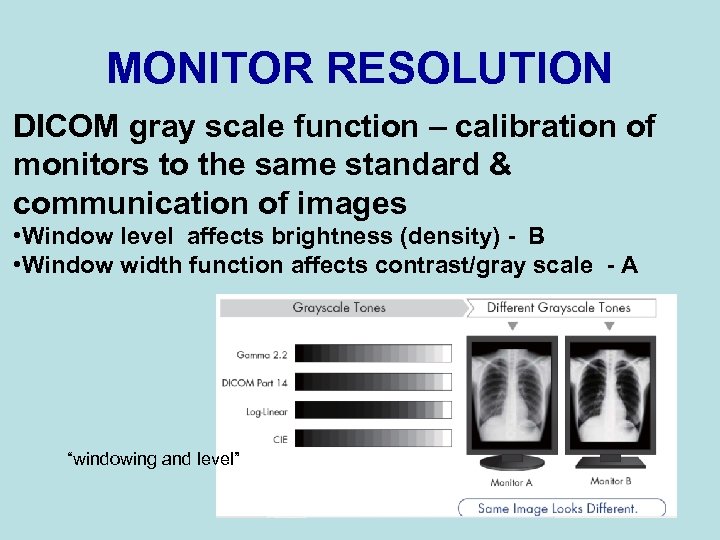 MONITOR RESOLUTION DICOM gray scale function – calibration of monitors to the same standard
