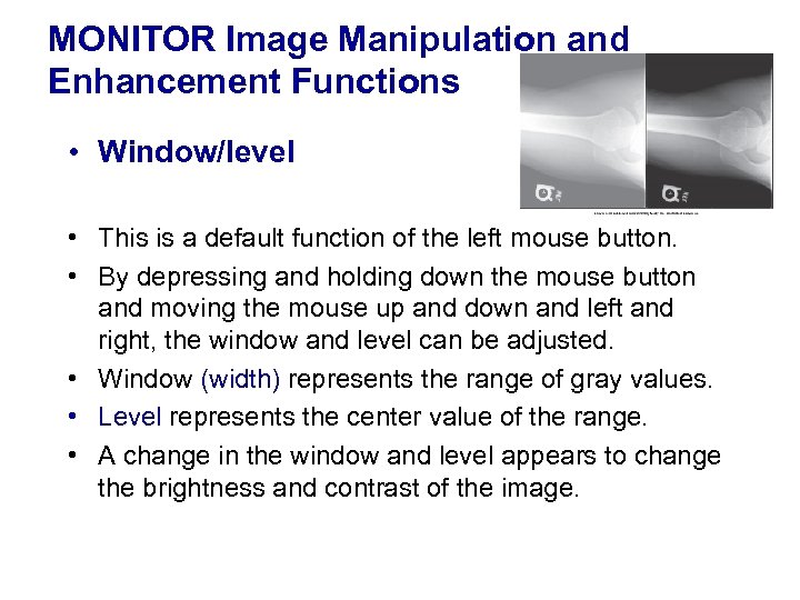 MONITOR Image Manipulation and Enhancement Functions • Window/level • This is a default function