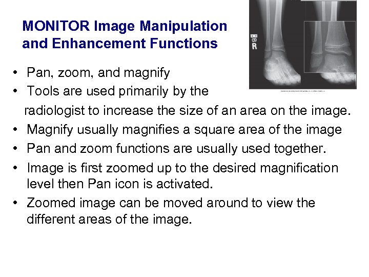 MONITOR Image Manipulation and Enhancement Functions • Pan, zoom, and magnify • Tools are