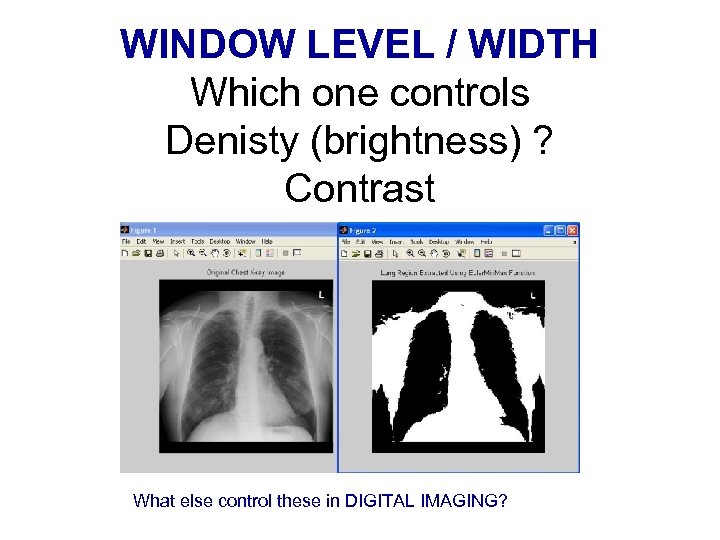 WINDOW LEVEL / WIDTH Which one controls Denisty (brightness) ? Contrast What else control