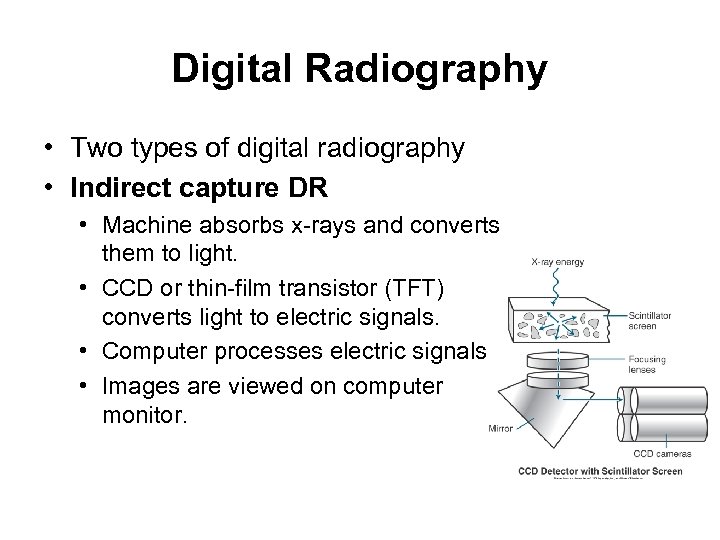 Digital Radiography • Two types of digital radiography • Indirect capture DR • Machine