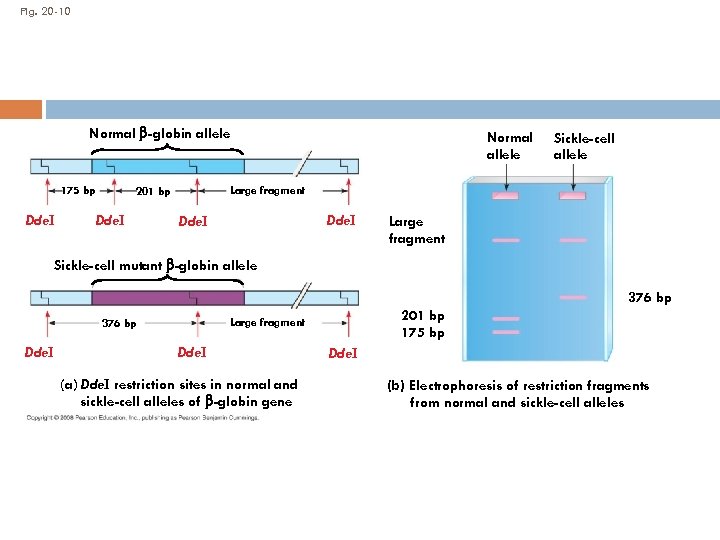 Fig. 20 -10 Normal -globin allele 175 bp Dde. I Sickle-cell allele Large fragment