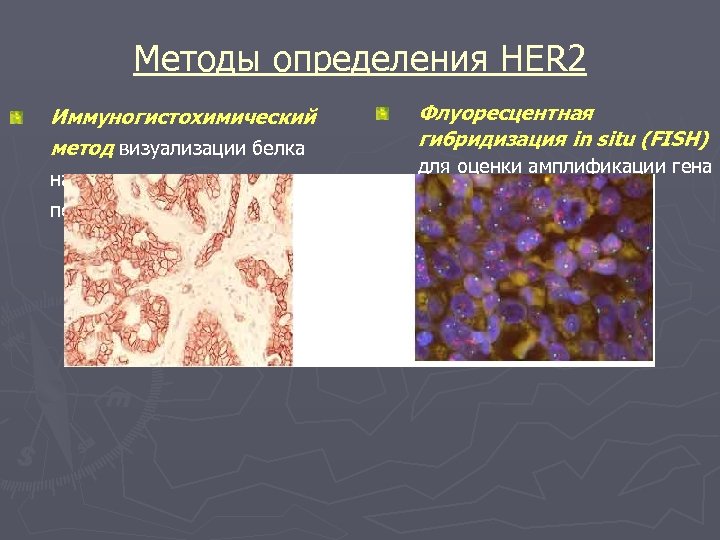 Методы определения HER 2 Иммуногистохимический метод визуализации белка на опухолевых клетках – первичный скрининг:
