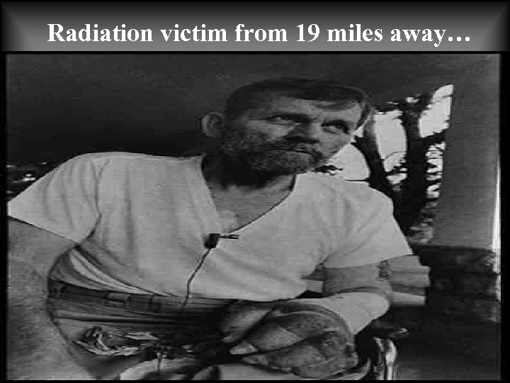 Radiation victim from 19 miles away… 