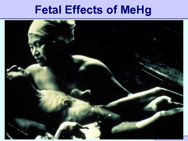 Fetal Effects of Me. Hg 