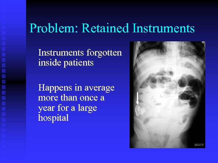 Problem: Retained Instruments forgotten inside patients Happens in average more than once a year