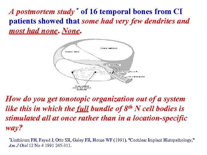 A postmortem study * of 16 temporal bones from CI patients showed that some