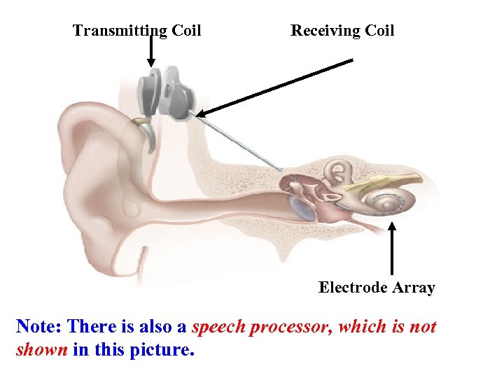 Transmitting Coil Receiving Coil Electrode Array Note: There is also a speech processor, which