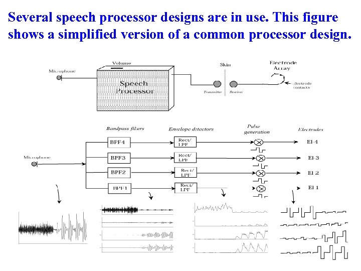 Several speech processor designs are in use. This figure shows a simplified version of