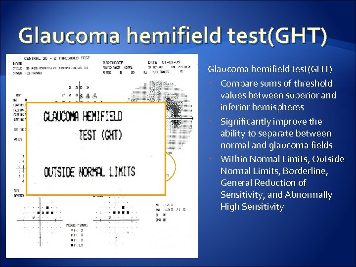 Glaucoma hemifield test(GHT) Compare sums of threshold values between superior and inferior hemispheres Significantly