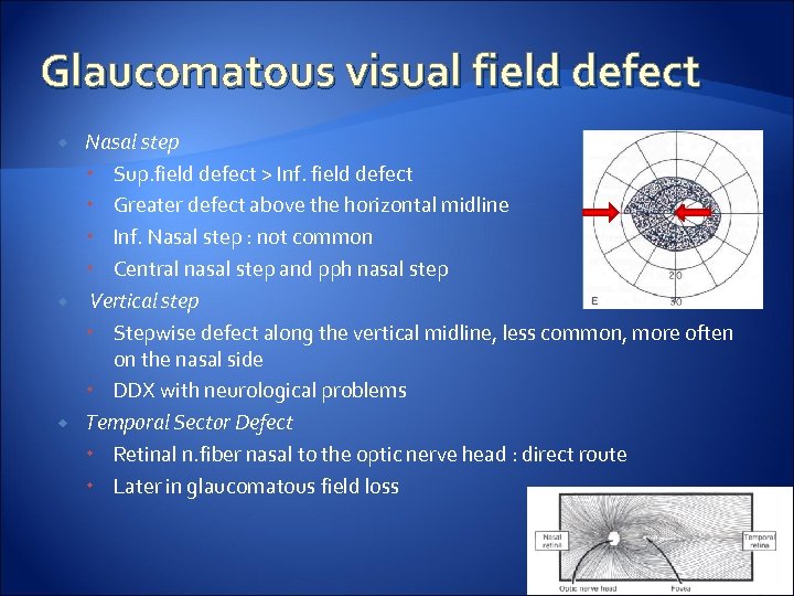 Glaucomatous visual field defect Nasal step Sup. field defect > Inf. field defect Greater