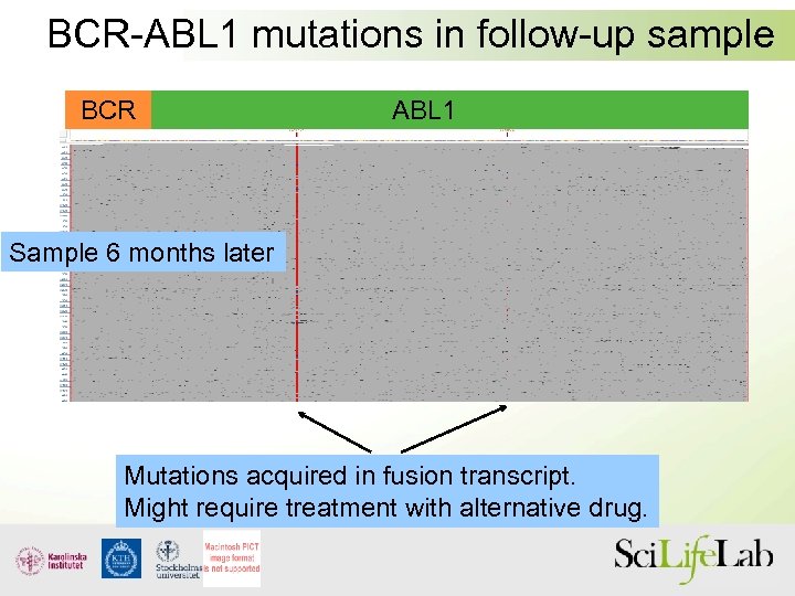 BCR-ABL 1 mutations in follow-up sample BCR ABL 1 Sample 6 months later Mutations