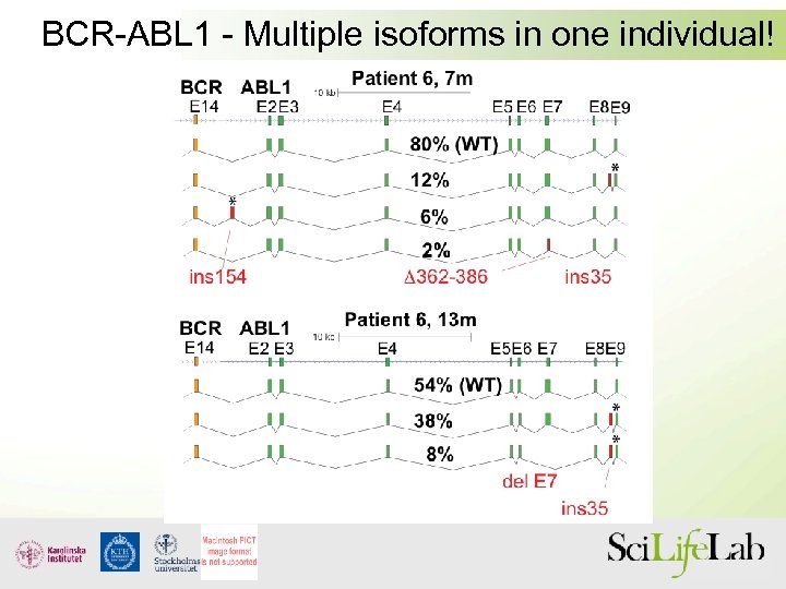 BCR-ABL 1 - Multiple isoforms in one individual! 
