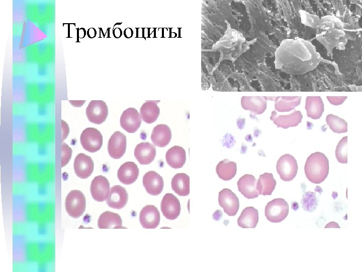 Тромбоциты 