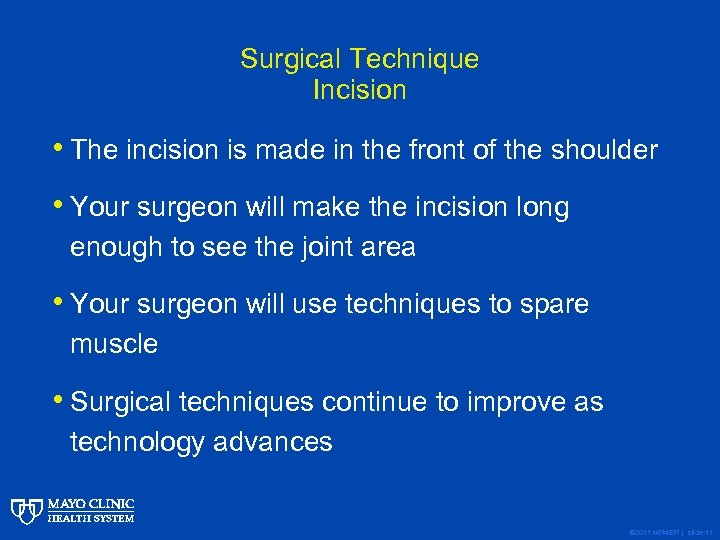 Surgical Technique Incision • The incision is made in the front of the shoulder