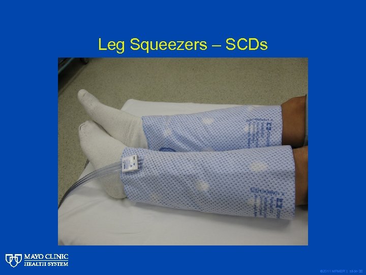 Leg Squeezers – SCDs © 2011 MFMER | slide-38 