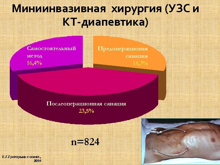 Миниинвазивная хирургия (УЗС и КТ-диапевтика) Самостоятельный метод 16, 4% Предоперационая санация 15, 3% Послеоперационная