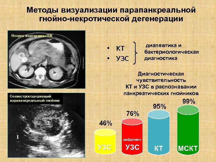 Методы визуализации парапанкреальной гнойно-некротической дегенерации Некроз паренхимы ПЖ • КТ • УЗС диапевтика и