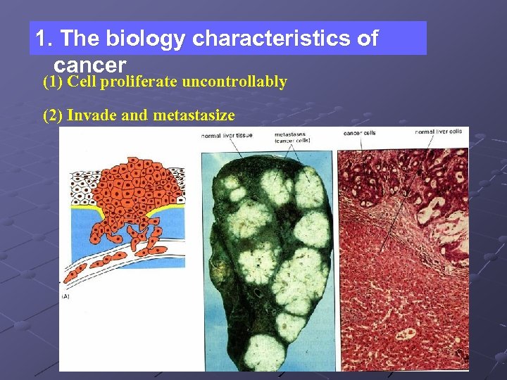 1. The biology characteristics of cancer (1) Cell proliferate uncontrollably (2) Invade and metastasize