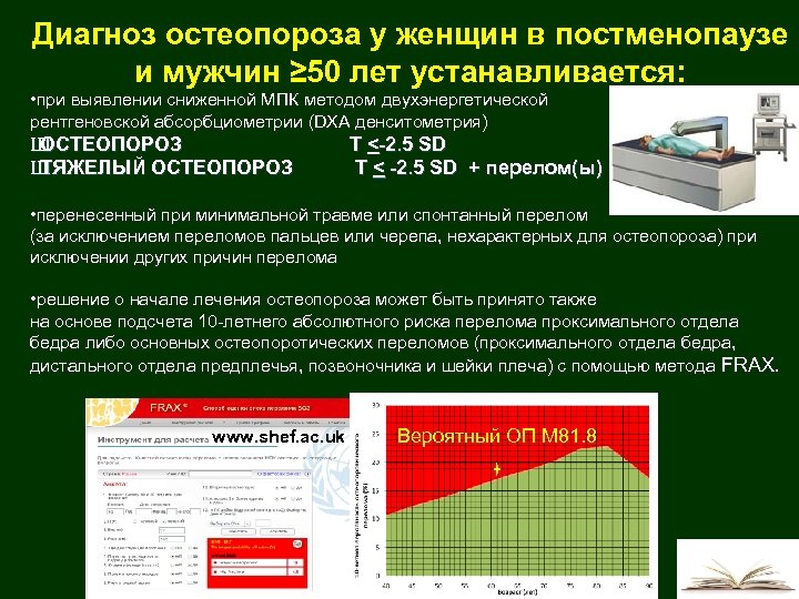 Диагноз остеопороза у женщин в постменопаузе и мужчин ≥ 50 лет устанавливается: • при