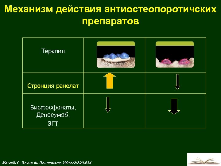Механизм действия антиостеопоротичских препаратов Терапия Стронция ранелат Бисфосфонаты, Деносумаб, ЗГТ Marcelli C. Revue du