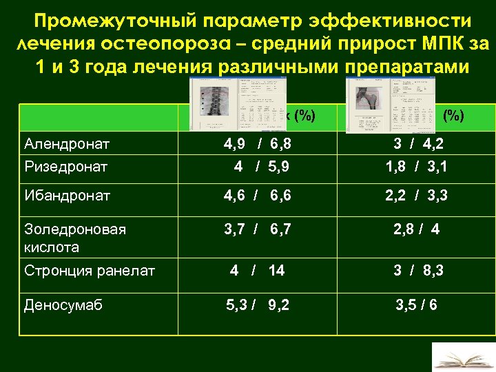 Промежуточный параметр эффективности лечения остеопороза – средний прирост МПК за 1 и 3 года