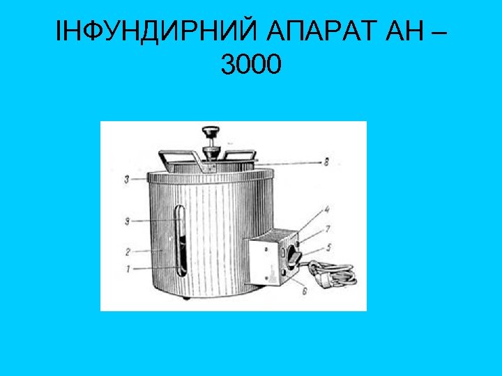 ІНФУНДИРНИЙ АПАРАТ АН – 3000 