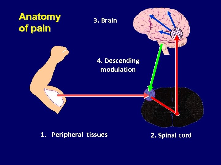 Anatomy of pain 3. Brain 4. Descending modulation 1. Peripheral tissues 2. Spinal cord
