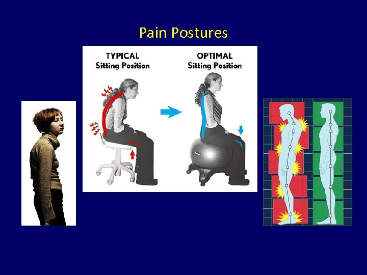 Pain Postures 