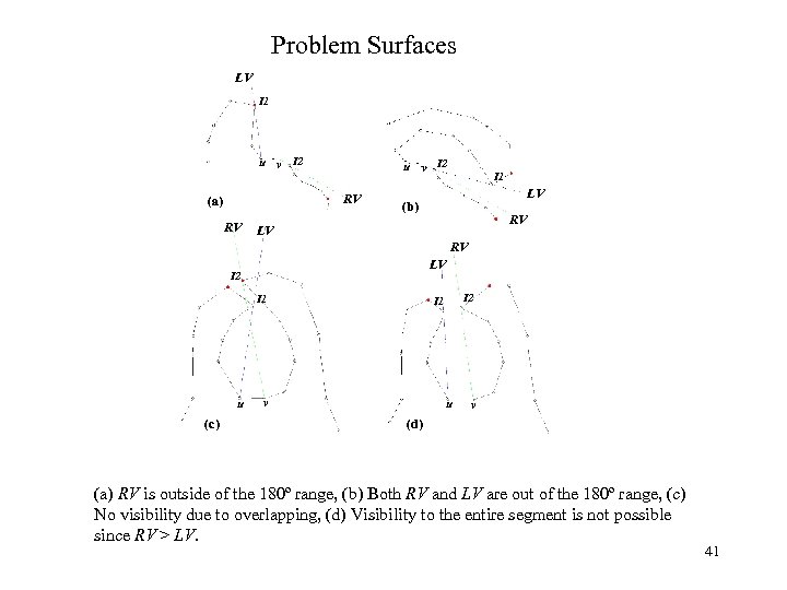 Problem Surfaces LV I 1 u v I 2 RV (a) RV I 1