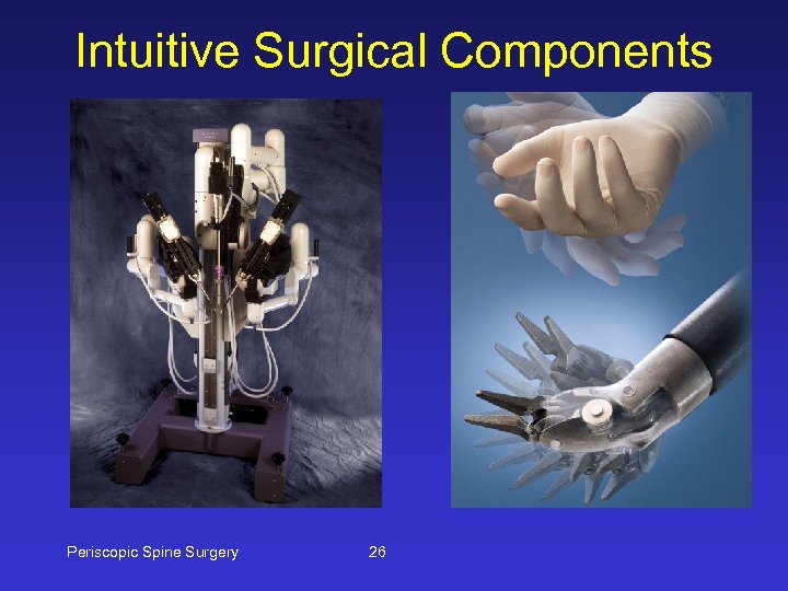 Intuitive Surgical Components Periscopic Spine Surgery 26 