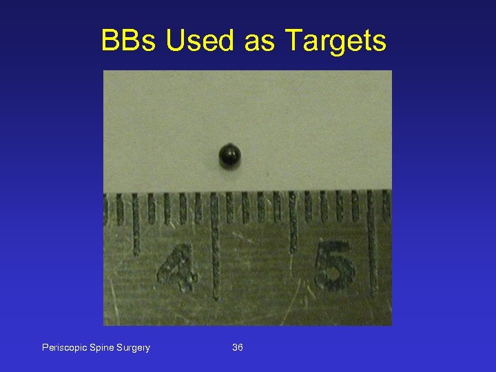 BBs Used as Targets Periscopic Spine Surgery 36 