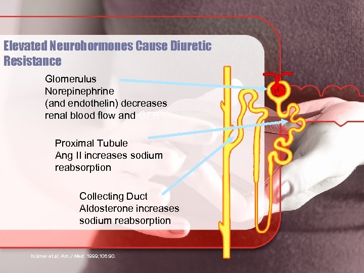 Elevated Neurohormones Cause Diuretic Resistance Glomerulus Norepinephrine (and endothelin) decreases renal blood flow and