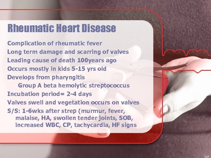 Rheumatic Heart Disease Complication of rheumatic fever Long term damage and scarring of valves