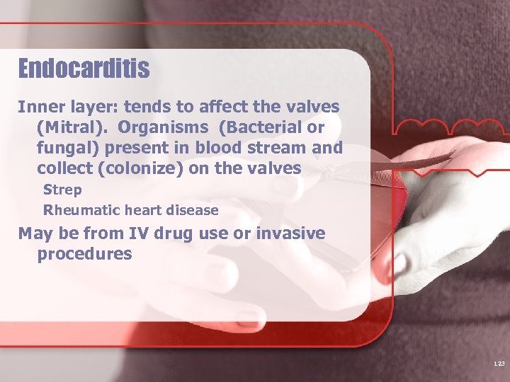 Endocarditis Inner layer: tends to affect the valves (Mitral). Organisms (Bacterial or fungal) present