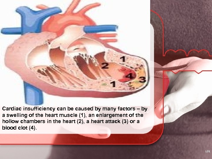 Cardiac insufficiency can be caused by many factors – by a swelling of the