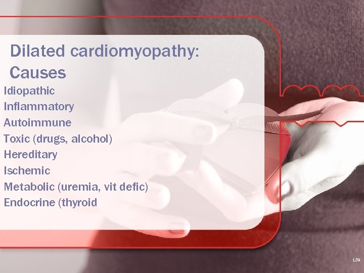 Dilated cardiomyopathy: Causes Idiopathic Inflammatory Autoimmune Toxic (drugs, alcohol) Hereditary Ischemic Metabolic (uremia, vit