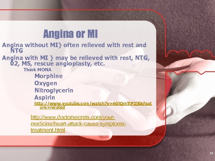 Angina or MI Angina without MI} often relieved with rest and NTG Angina with