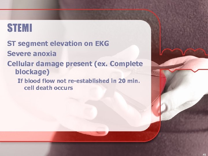 STEMI ST segment elevation on EKG Severe anoxia Cellular damage present (ex. Complete blockage)