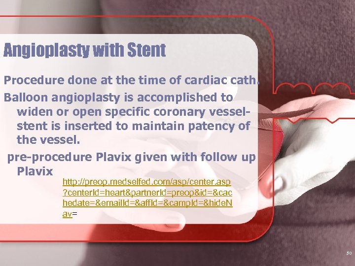 Angioplasty with Stent Procedure done at the time of cardiac cath. Balloon angioplasty is