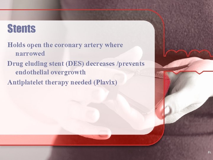 Stents Holds open the coronary artery where narrowed Drug eluding stent (DES) decreases /prevents
