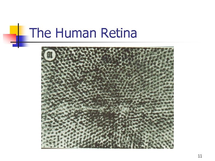 The Human Retina 11 